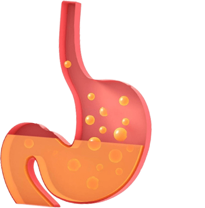 Gastrointestinal Complaints
                