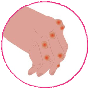 Skin Complaints